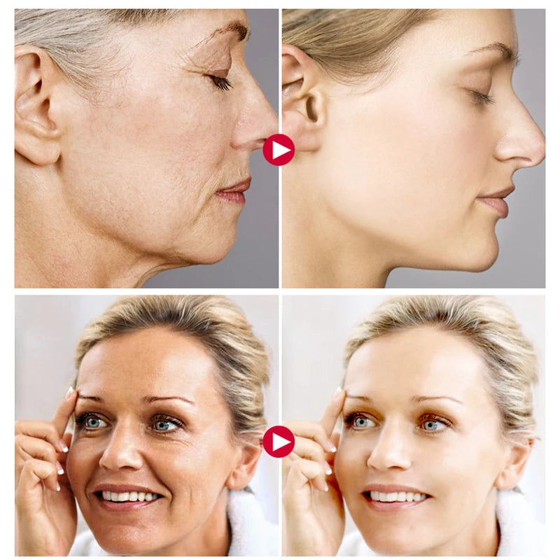 Anti Aging skin Care Set